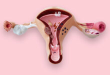 آیا پس از هیسترکتومی امکان بارداری نیست؟