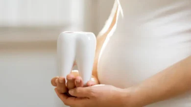 آیا روکش کردن دندان در دوران بارداری مجاز است؟