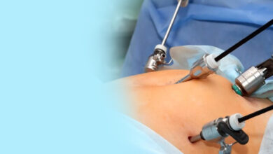 آیا عمل لاپاراسکوپی درد دارد؟