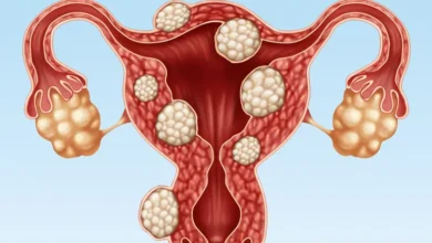 آیا عمل میومکتومی دردناک است؟