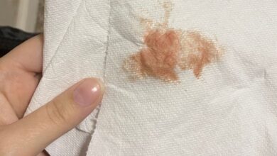 لکه بینی و خونریزی خفیف بعد از سرکلاژ طبیعی است؟