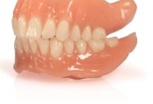 بررسی کیفیت دندان مصنوعی ایوکلار Ivoclar