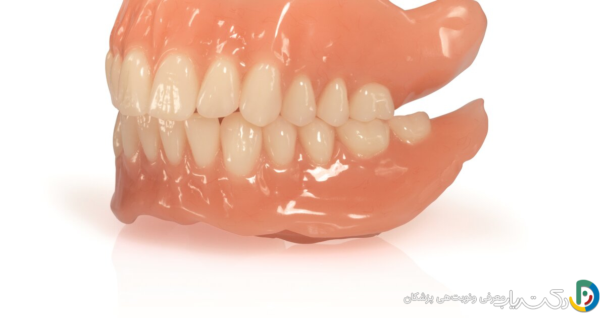 بررسی کیفیت دندان مصنوعی ایوکلار Ivoclar