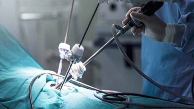 لاپاراسکوپی چیست؟ عمل لاپاراسکوپی چگونه انجام میشود؟