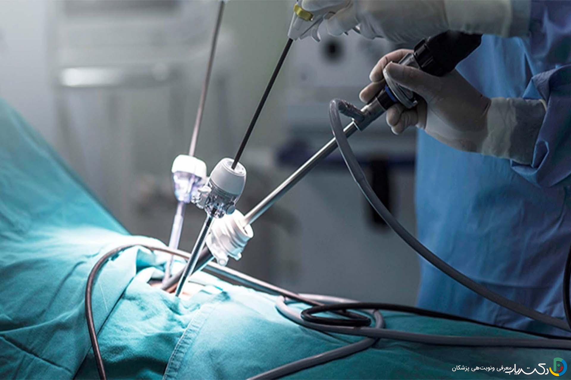 لاپاراسکوپی چیست؟ عمل لاپاراسکوپی چگونه انجام میشود؟