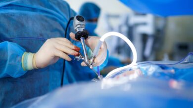 گاز داخل شکم بعد از لاپاراسکوپی کی خارج میشود؟