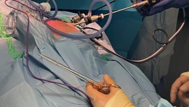 بهترین پماد برای جای زخم لاپاراسکوپی چیست؟