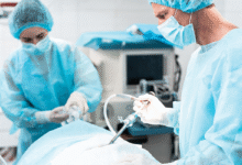 چند روز بعد از لاپاراسکوپی میتوان رانندگی کرد؟