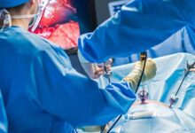 آیا میتوانم بعد از لاپاراسکوپی رابطه زناشویی داشته باشم؟