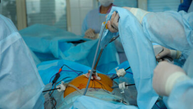 آیا لاپاراسکوپی برای بستن لولههای رحم (توبکتومی) استفاده میشود؟