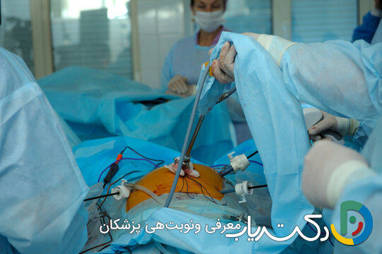 آیا لاپاراسکوپی برای بستن لوله‌های رحم (توبکتومی) استفاده می‌شود؟