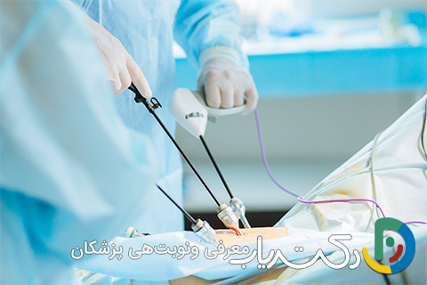 لاپاراسکوپی کیست تخمدان چگونه است؟