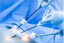 آمادگی قبل از عمل لاپاراسکوپی چیست؟