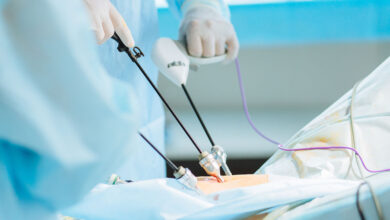 چه زمانی بخیههای لاپاراسکوپی کشیده یا جذب میشوند؟