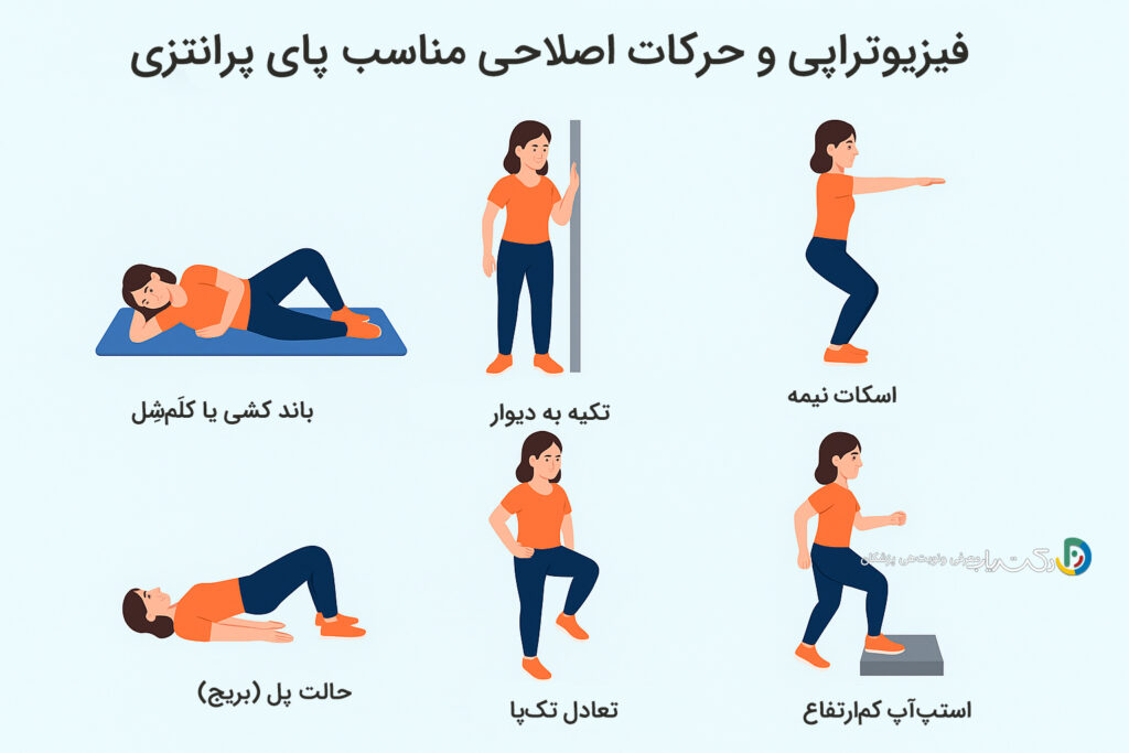 فیزیوتراپی و تمرینات ورزشی مخصوص پای پرانتزی