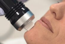 هزینه آراف فرکشنال در تهران (جدول قیمت 1404)