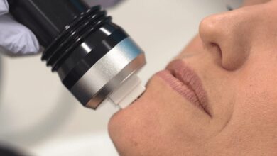 هزینه آراف فرکشنال در تهران (جدول قیمت 1404)