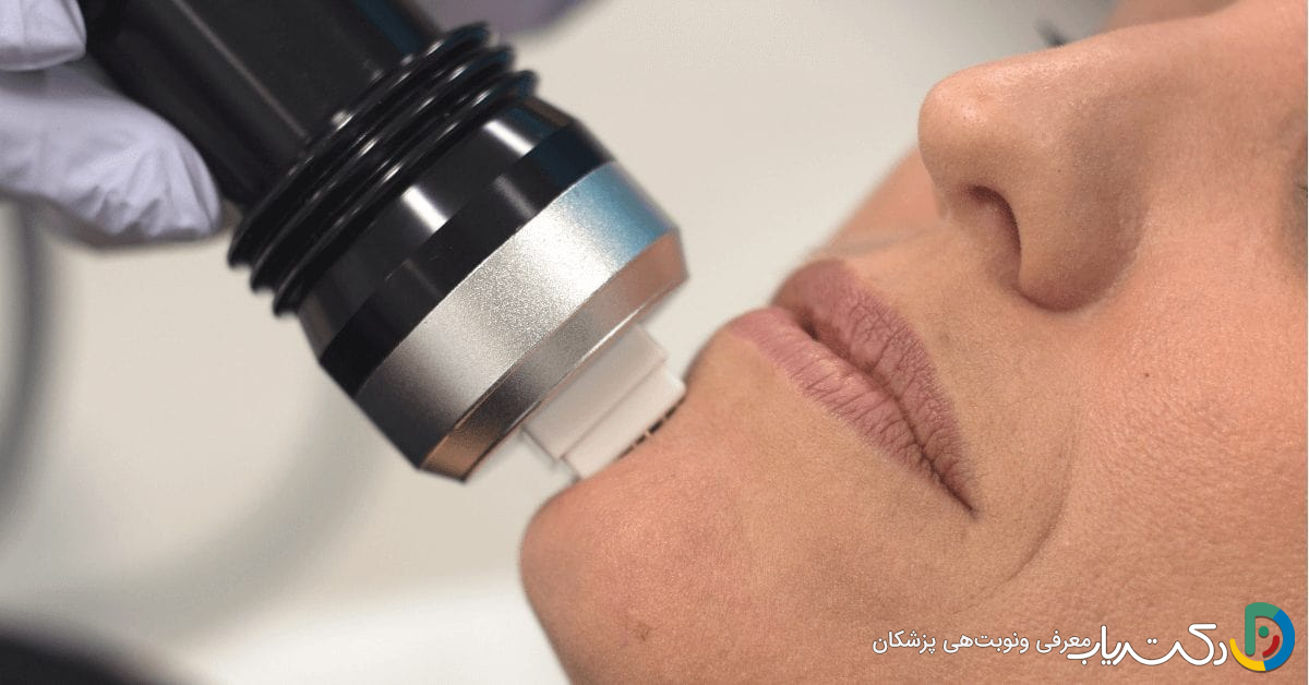 هزینه آراف فرکشنال در تهران (جدول قیمت 1404)