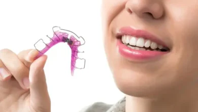 ارتودنسی متحرک چیست و برای چه کسانی مناسب است؟