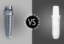 تفاوت ایمپلنت تیتانیومی با ایمپلنت زیرکونیا چیست؟