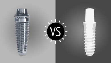 تفاوت ایمپلنت تیتانیومی با ایمپلنت زیرکونیا چیست؟