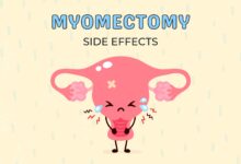عوارض عمل میومکتومی چیست؟