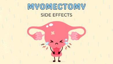 عوارض عمل میومکتومی چیست؟