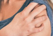 علت شانه درد بعد از عمل لاپاراسکوپی چیست؟