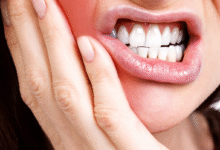 علت تورم و آبسه بعد از عصب کشی چیست؟