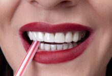 کامپوزیت IPS چیست؟ مزایای آن