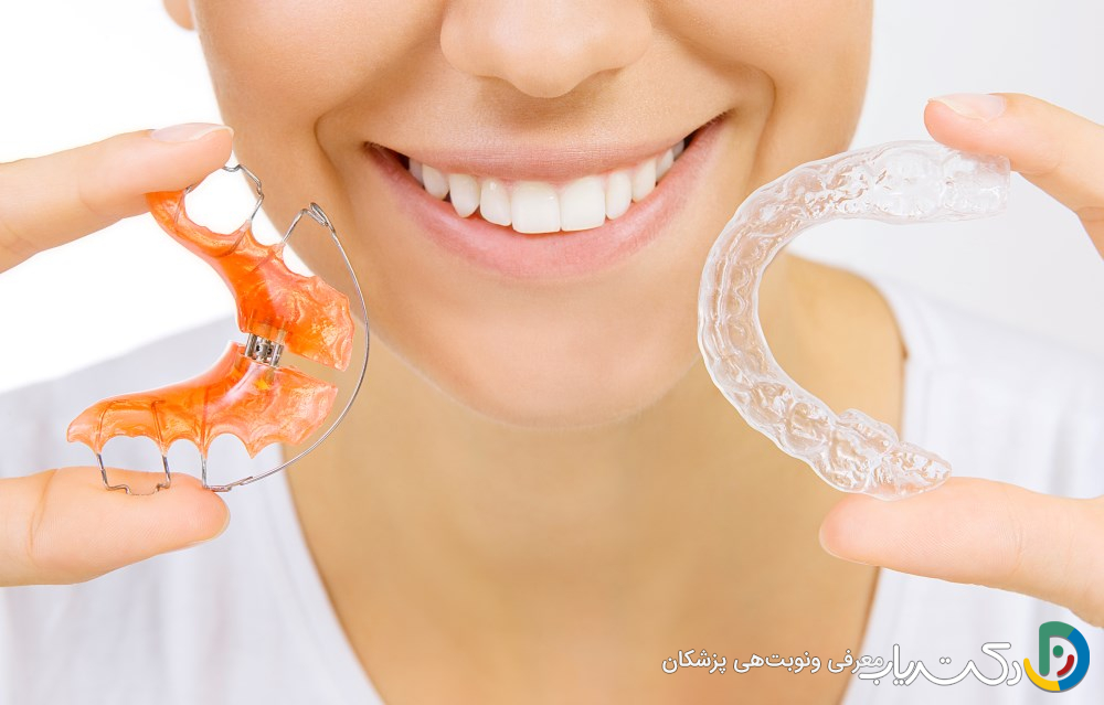 پلاک ارتودنسی متحرک چیست؟