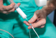 بیهوشی در عمل سرکلاژ چگونه است؟ (بیحسی نخاعی یا بیهوشی کامل)