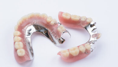 پروتز کروم کبالت دندان چیست ؟