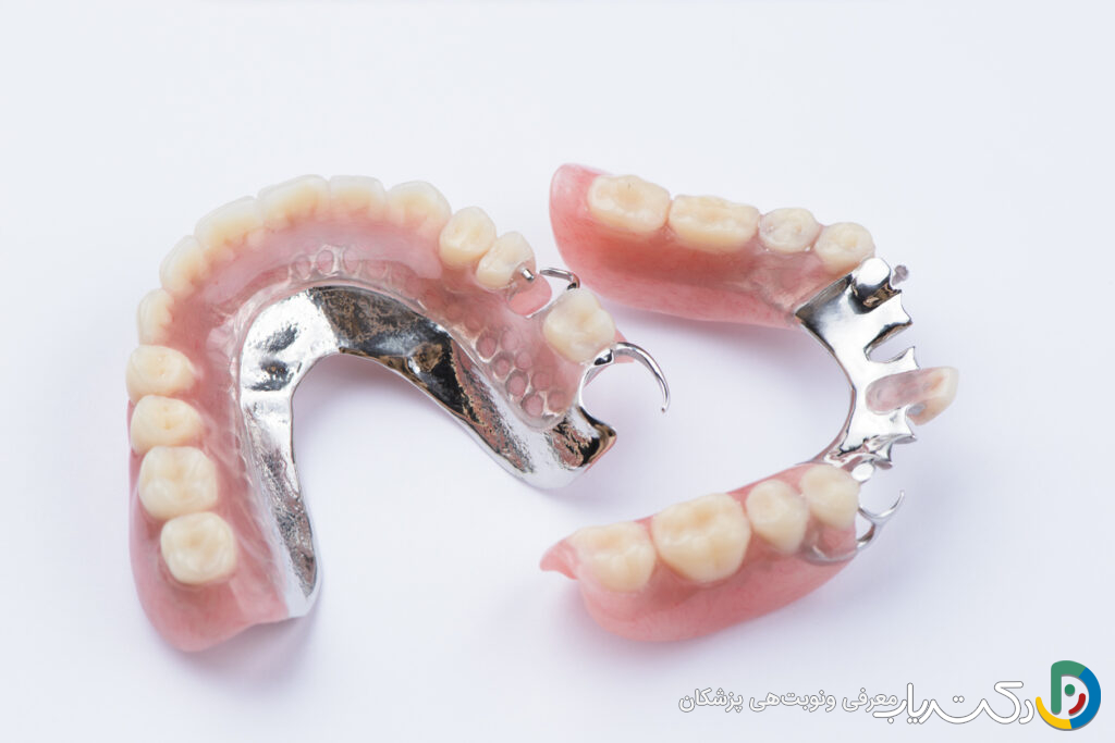 پروتز کروم کبالت دندان چیست ؟