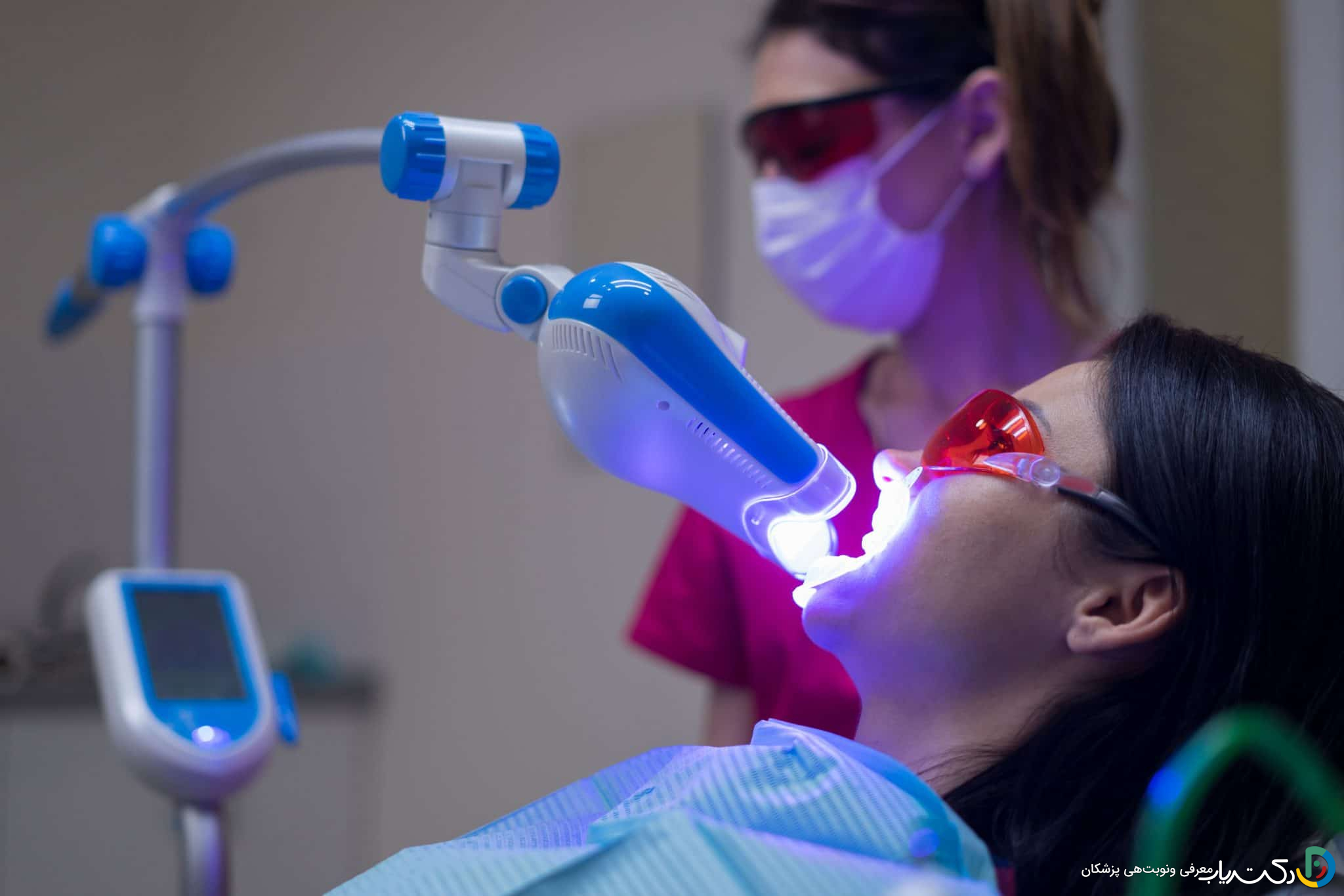 بلیچینگ با لیزر چگونه است؟