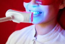 پاور بلیچینگ چیست و چگونه عمل می‌کند؟