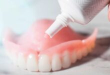 بهترین چسب دندان مصنوعی کدام است؟