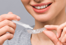 بهترین ژل برای بلیچینگ خانگی کدام است؟