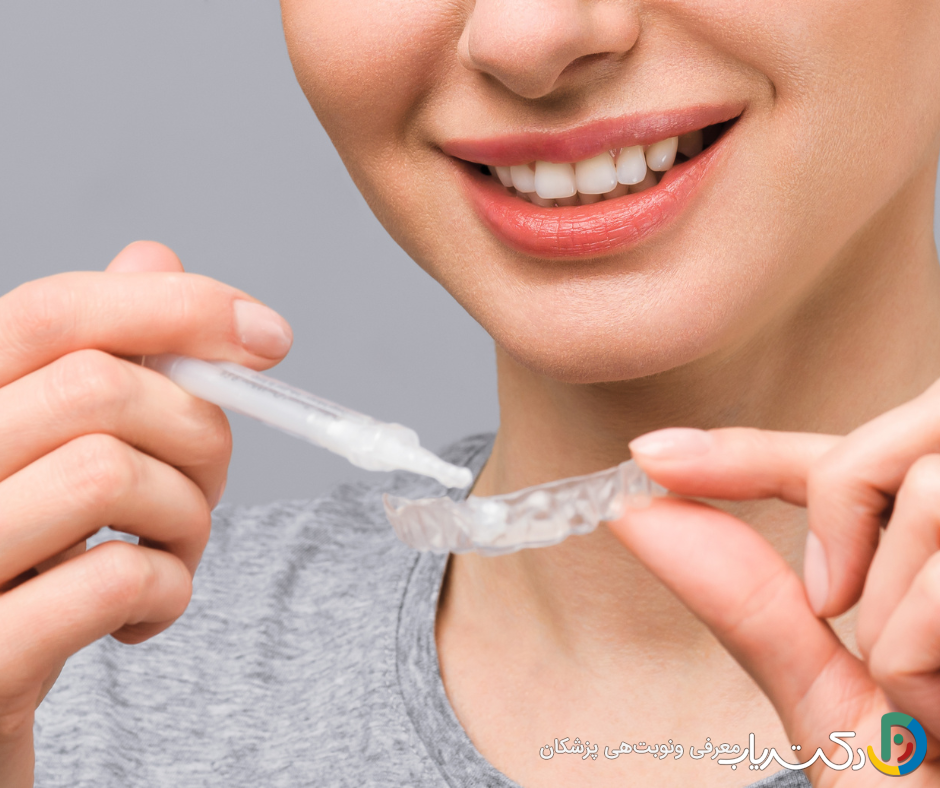 بهترین ژل برای بلیچینگ خانگی کدام است؟