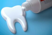 بهترین خمیر دندان برای کامپوزیت چیست؟