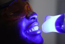 تفاوت بلیچینگ با لیزر و بلیچینگ معمولی چیست؟