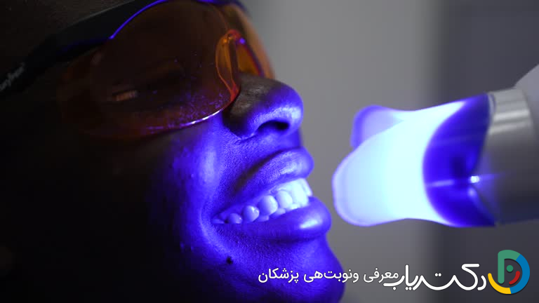 تفاوت بلیچینگ با لیزر و بلیچینگ معمولی چیست؟