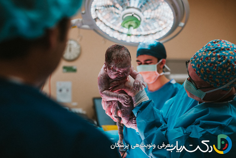 مراقبت های بعد از عمل سزارین چیست؟