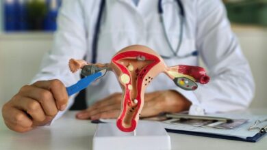 مراقبت های بعد از عمل هیستروسکوپی چیست؟