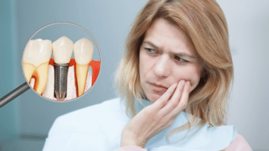 برای کاهش درد بعد از جراحی ایمپلنت چه باید کرد؟