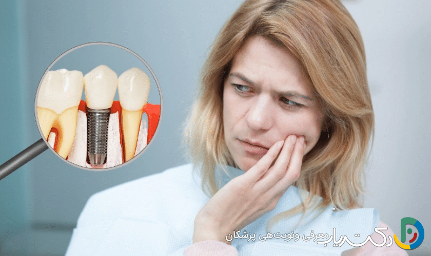 برای کاهش درد بعد از جراحی ایمپلنت چه باید کرد؟