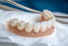 کدام برند دندان مصنوعی رنگ پذیری کمتری دارد؟