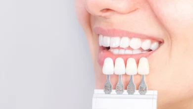 برای دندان جلو کدام روکش بهتر است؟ از نظر زیبایی