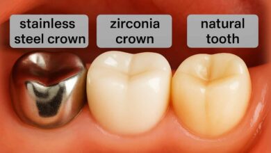 برای دندان های عقب کدام روکش مقاوم تر است؟