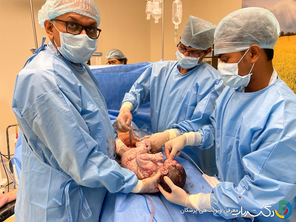 آیا انجام سزارین در صورتی که فشار خون بالا داشته باشم ایمن است؟